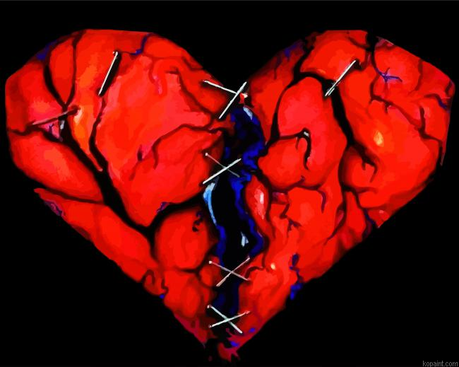 Broken Heart Painting By Numberss.png